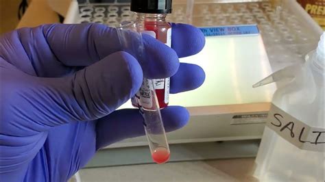 Image result for Dat Positive