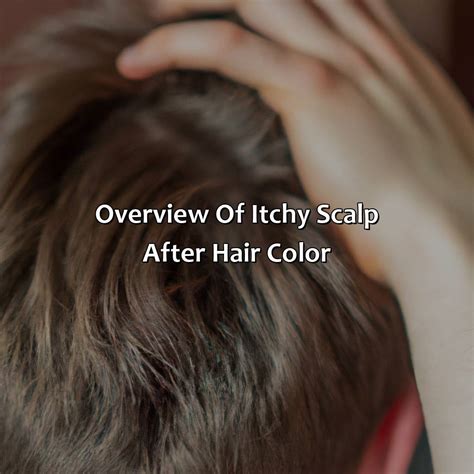 Itchy Scalp After Hair Color Treatment at Lois Toussaint blog