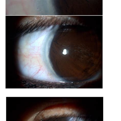 Image result for Transillumination Normal Head