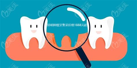 上海种植牙价格一般多少钱?纳入医保政策的集采种植牙3000起 - 口腔资讯 - 牙齿矫正网