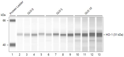 Metalloporphyrins Reduce Proteinuria in Podocyte Immune Injury: The ...