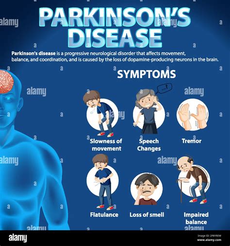 Informative poster of Parkinson disease illustration Stock Vector Image & Art - Alamy