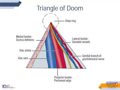 eTEP_for_Inguinal Hernias_Dr_Sanjiv_Haribhakti_www.gisurgery.info (1).pdf