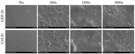 Glow Discharge Plasma Treatment on Zirconia Surface to Enhance ...