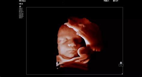 Philips EPIQ 7 ultrasound machine