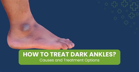 Why Are Veins Blue? The Truth Behind the Color of Your Veins - Palos Healthcare Center