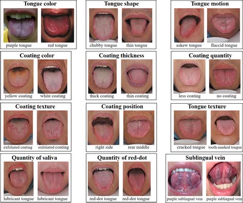 What Is It When You Have Black Spots On Your Tongue In Chinese Age - Infoupdate.org