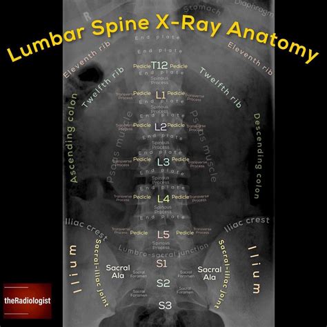 Albums 100+ Pictures Normal Lumbar Spine X-ray Images Sharp