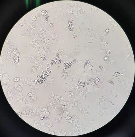 细胞真菌生物结构图片素材-正版创意图片400203572-摄图网