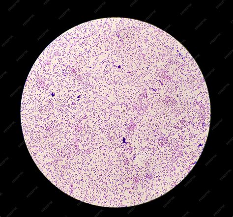 Staphylococcus Epidermidis 100x