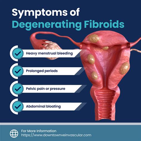 What are Degenerating Fibroids?