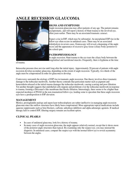 Angle Recession 的图像结果