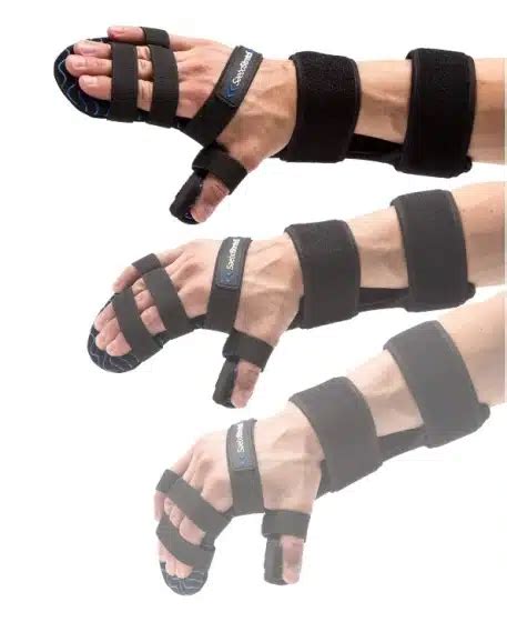 Image result for Dynamic Hand Splint