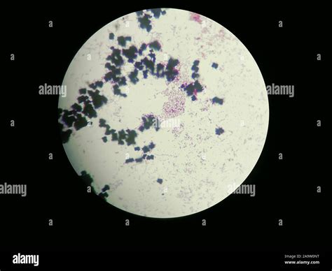 Image of Escherichia coli obtained through a light microscope. For any ...