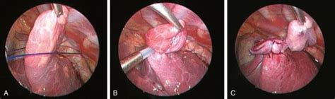 Paediatric Laparoscopic Surgeon in Tambaram | Paediatric Laparoscopic ...