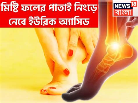 High Uric Acid Control Tips: পেয়ারা পাতাতেই সারবে ইউরিক অ্যাসিড ...