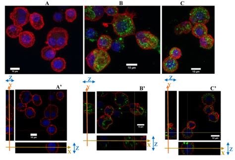 Repeated vs. Acute Exposure of RAW264.7 Mouse Macrophages to Silica ...