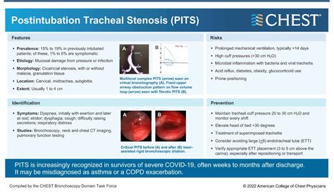 Post intubation tracheal stenosis – Critical Care Update