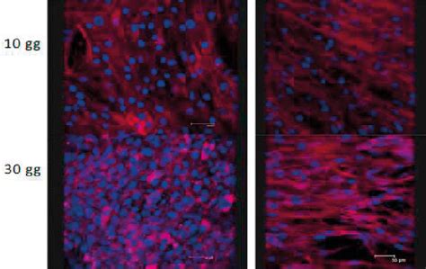 Image result for Fibronectin Medication