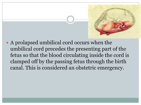 Cord prolapse & cord presentation | PPTX