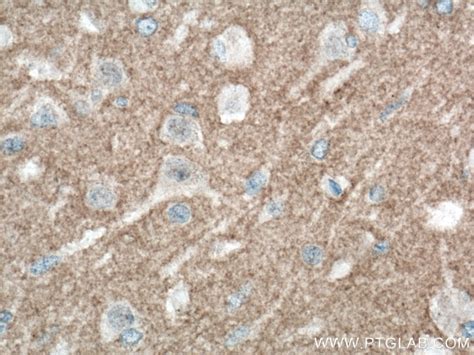 L1CAM/CD171 antibody (67115-1-Ig) | Proteintech