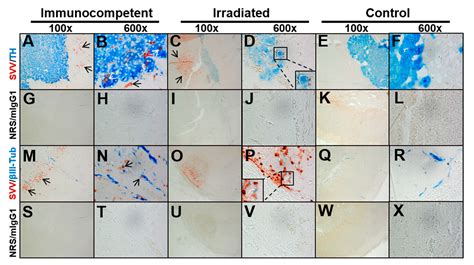 Histopathological Analysis of Adrenal Glands after Simian Varicella ...