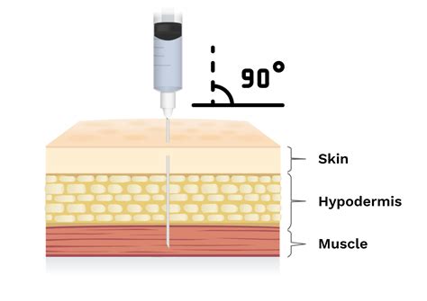 Angle of Injection 的图像结果