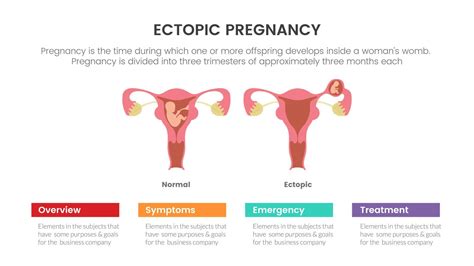 ectopic pregnant or pregnancy infographic concept for slide presentation with 3 point list ...