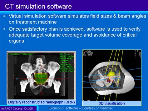 What Is CT Simulation 的图像结果