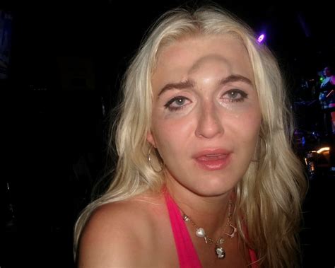 Woman left with huge bump on head after nightclub fail - What's The Jam