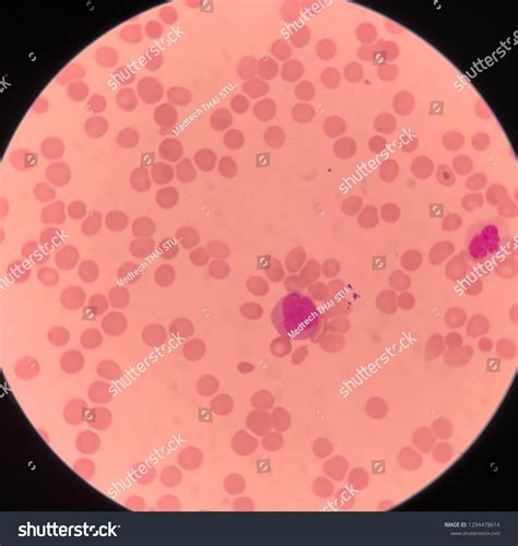 Image result for Monocyte Under Microscope