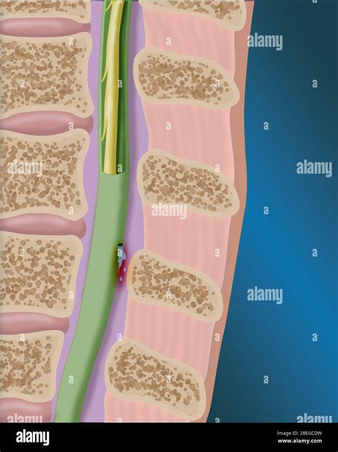 Cerebrospinal Fluid Color