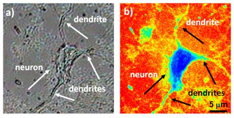 Applied Sciences | Special Issue : Recent Advances in Optical Bioimaging