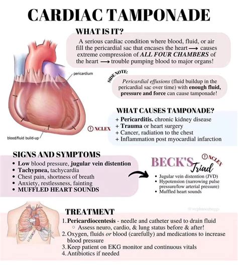 Pericardial tamponade what is it causes pericardial effusion signs diagnosis treatment and more ...