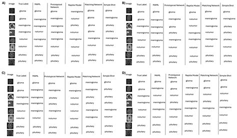 Evaluating Machine Learning Techniques for Brain Tumor Detection with ...