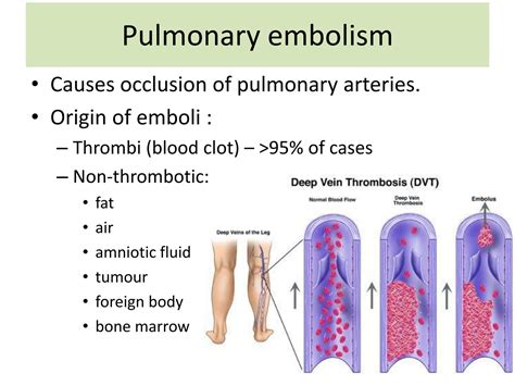 SOLUTION: Pulmonary vascular diseases 2019 autosaved - Studypool
