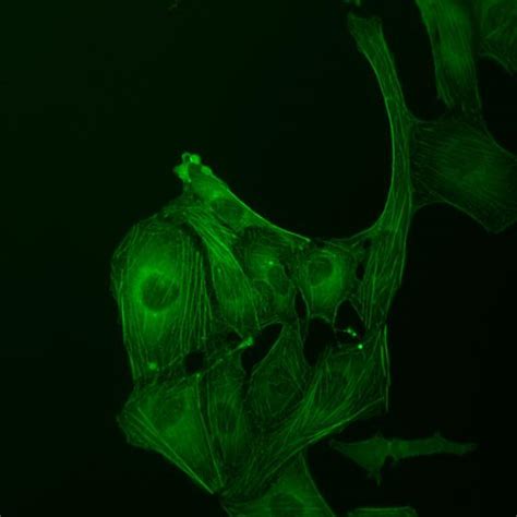 ZEISS Primovert – Inverses Mikroskop für die Zellkulturbetrachtung