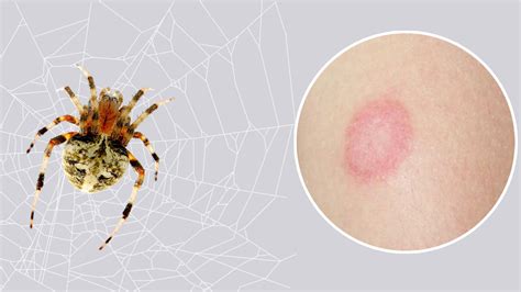 Barn Spider: Size, Color, Bite, life Cycle, Habitat & Facts