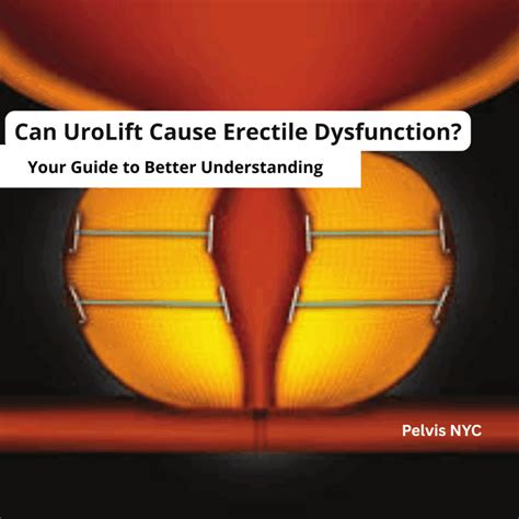 How Do You Stop Urine Leakage After Prostate Surgery? - Pelvis.nyc