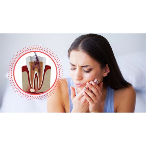 What Works Best for Root Canal Pain Relief After Treatment - Smile Studio Boston