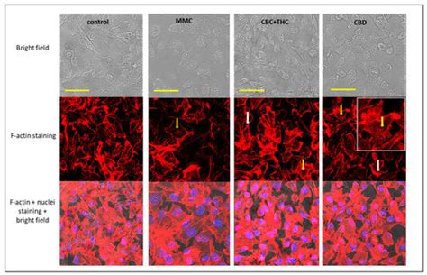 Cannabis-Derived Compounds Cannabichromene and Δ9-Tetrahydrocannabinol ...
