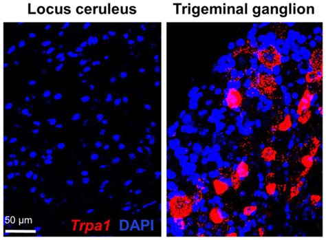 The Lack of TRPA1 Ion Channel Does Not Affect the Chronic Stress ...