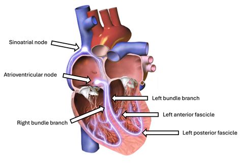 Bundle Branch Blocks and Hemiblocks – EKG Essentials: A Student Handbook