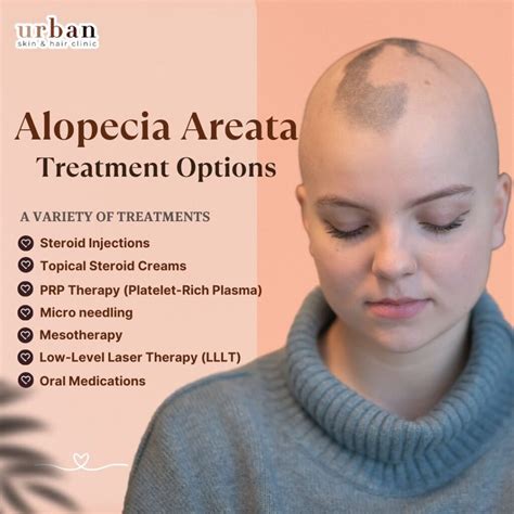 Best Clinic for Alopecia Areata Treatment | UrbanSkinHairClinic