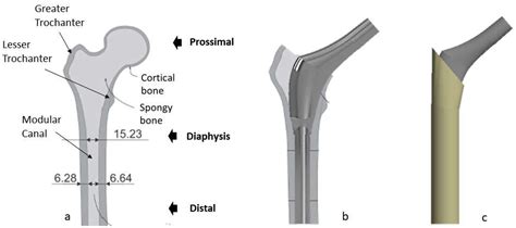 A Finite Element Analysis Study of Influence of Femoral Stem Material in Stress Shielding in a ...