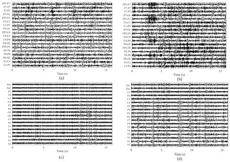 Multiscale Cosine Convolution Neural Network for Robust and ...