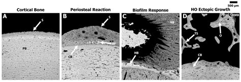 Determining Which Combinatorial Combat-Relevant Factors Contribute to ...