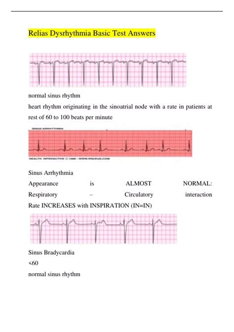 Basic Dysrhythmia Practice Test 的图像结果