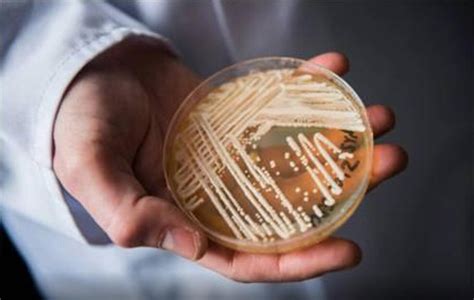 美国爆发“超级真菌”疫情，感染者无法治愈，这是什么真菌？_腾讯新闻