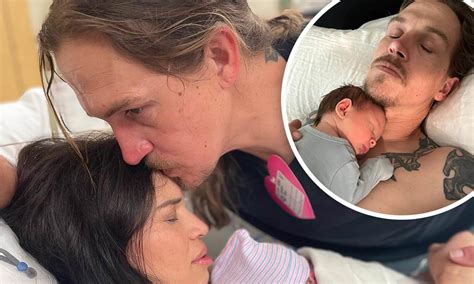 Jason Mewes Face Surgery